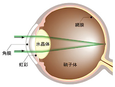 正常な眼