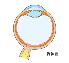 緑内障の症状