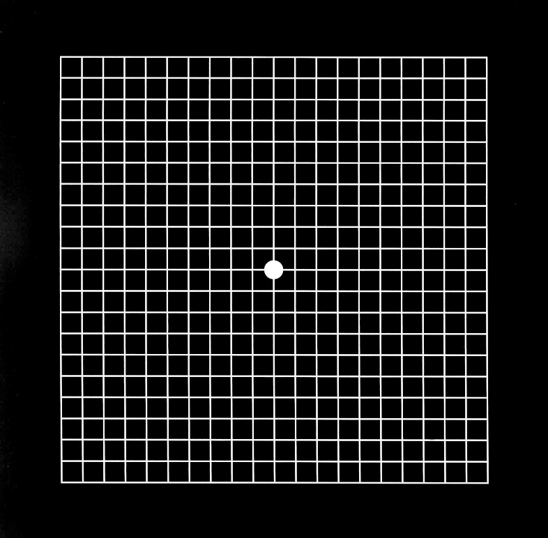 ゲーム の し すぎ 飛 蚊 症