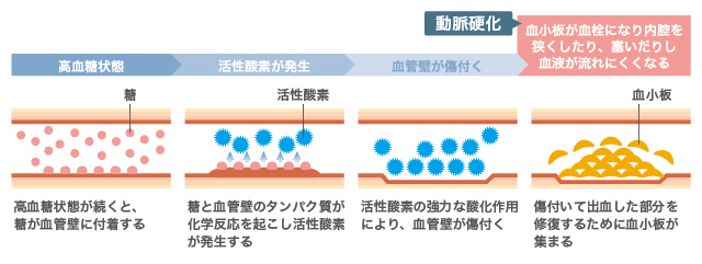 緑内障の原因と種類