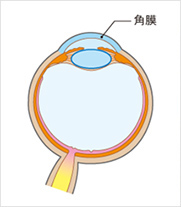 角膜炎