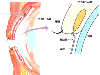 霰粒腫