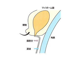 霰粒腫