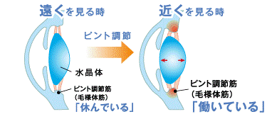 近視とは